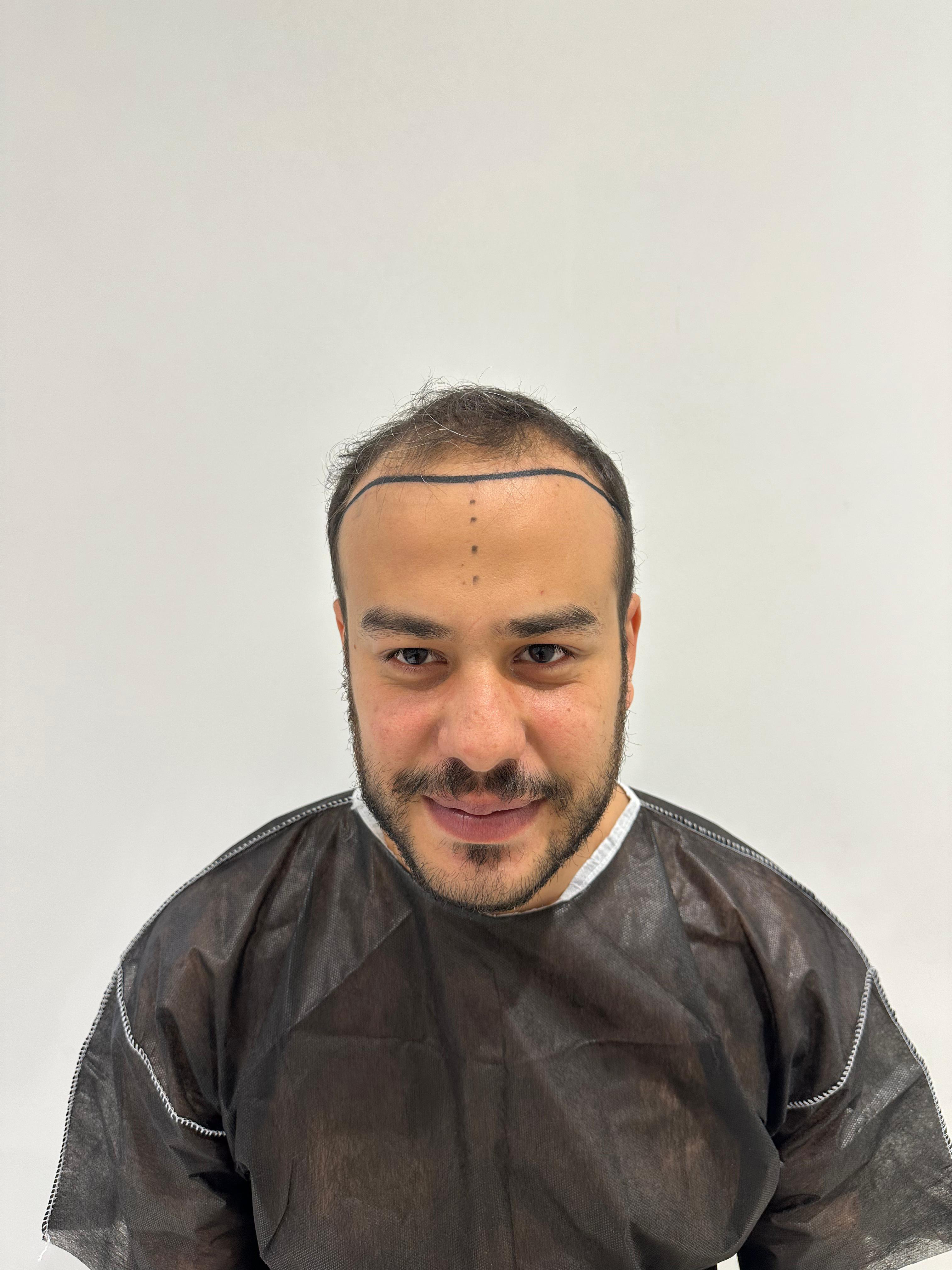 Après – FazenClinic